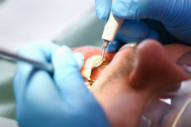 Best Emergency Gum Treatment in Necedah, WI