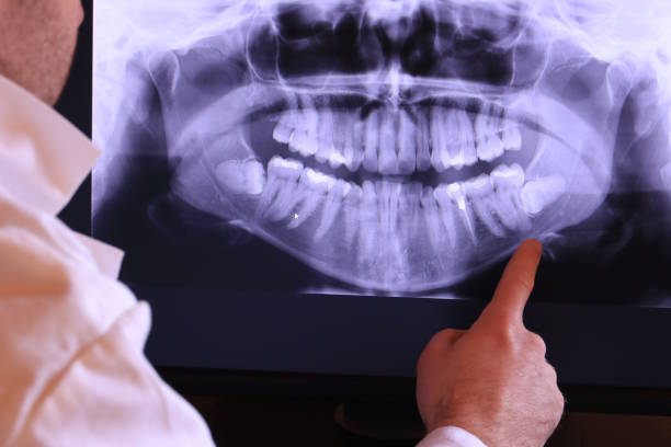Best Emergency Tooth Extraction in Necedah, WI